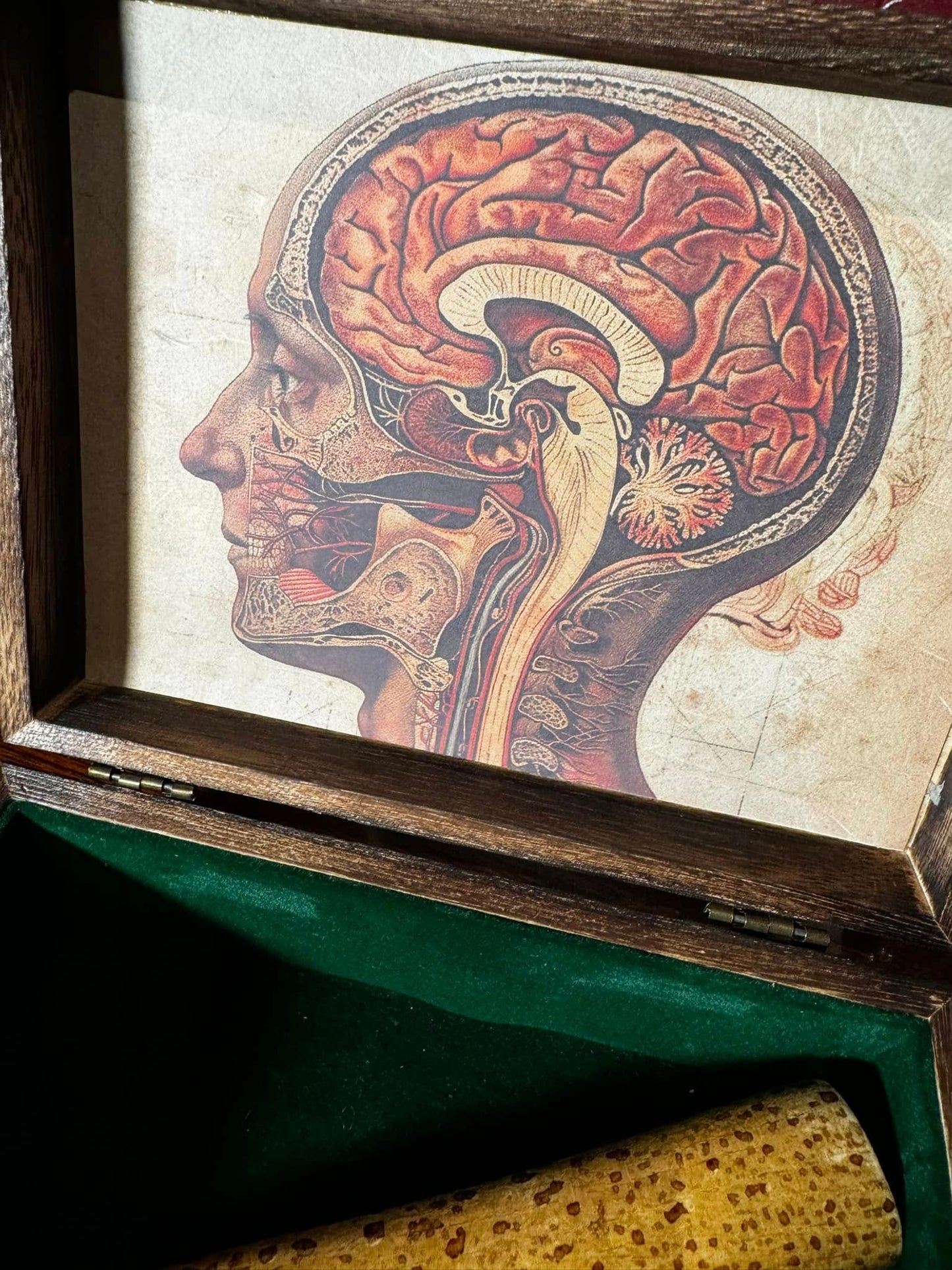 Cerebrum by Dead Rebel